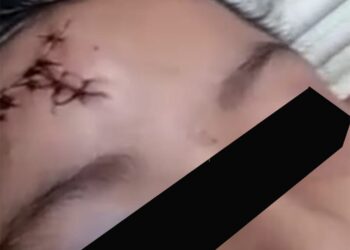 Ironia do destino ou crônica anunciada, portão de grade da Escola Paulo Freire desaba sobre aluna de 8 anos de idade 