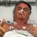 Bolsonaro deve ser transferido para hospital em Brasília