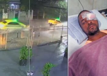 Tampa solta de bueiro faz táxi ‘voar’, e família diz que motorista perdeu a visão de um olho