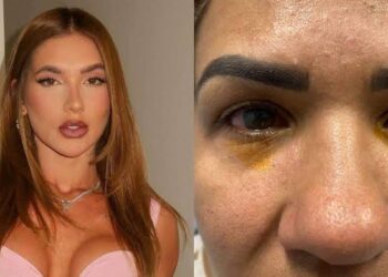 Mulher afirma ter ficado cega após usar produto de Virginia Fonseca