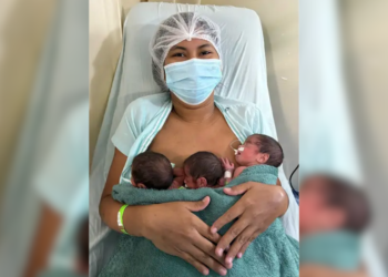 Grávida descobre que esperava trigêmeos só na hora do parto em Barcarena