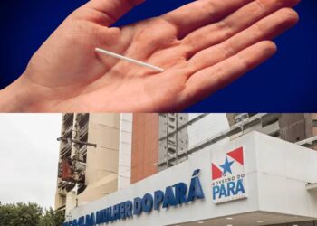 Hospital da Mulher oferece novo método contraceptivo gratuito pelo SUS