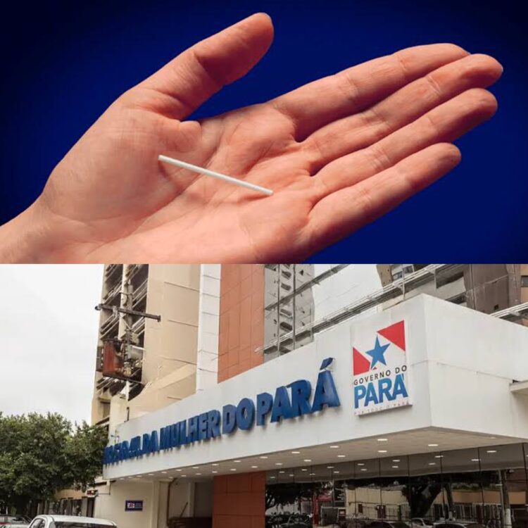 Hospital da Mulher oferece novo método contraceptivo gratuito pelo SUS