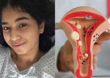 Jovem viraliza ao comemorar laqueadura aos 22 anos: “Sem marido e sem filhos, realizei o meu sonho”