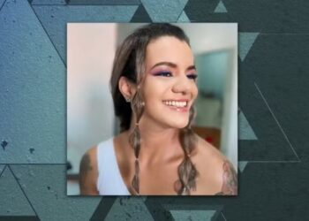 Mulher agr3dida com 61 socos em elevador ficou por sete horas em cirurgia para reconstruir a face