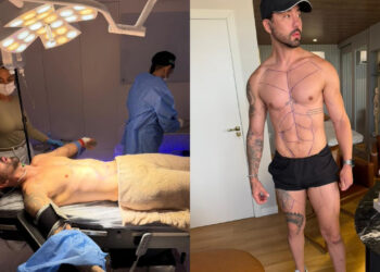 Influenciador Rico Melquiades fará cirurgia para renovar as pregas do orifício íntimo: ‘quero ficar mais apertado’