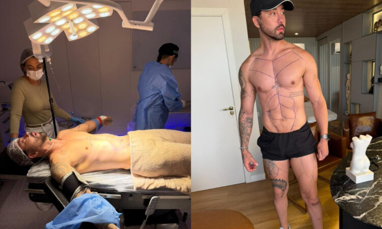 Influenciador Rico Melquiades fará cirurgia para renovar as pregas do orifício íntimo: ‘quero ficar mais apertado’