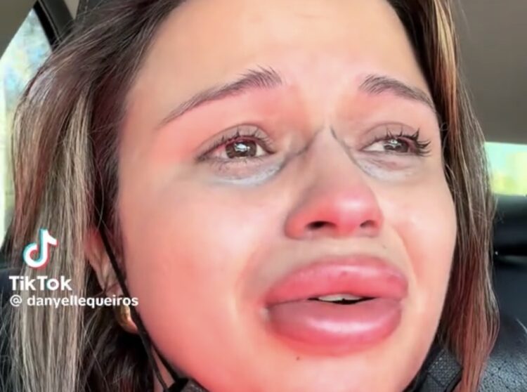 Arrependida, mulher chora após preenchimento labial e diz que procedimento “deveria ser proibido”