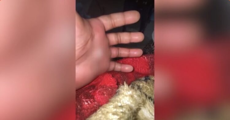 Jovem é picado por jararaca durante trilha no Parque do Utinga e está há 10 dias aguardando transferência no PSM da 14