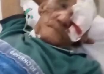 Idoso é brutalmente agredido pelo neto dentro da própria residência