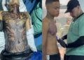 Vídeo de jovem usando anestesia geral para fazer tatuagens gera polêmica nas redes