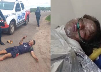 Morre mulher que teve o corpo incendiado pelo ex-marido em Salinópolis