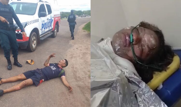 Morre mulher que teve o corpo incendiado pelo ex-marido em Salinópolis