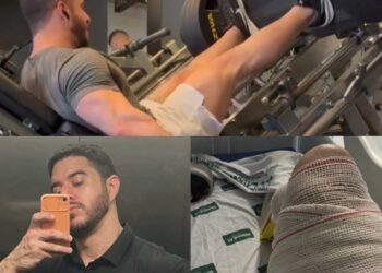 Fisiculturista rompe tendão ao levantar 400 kg em academia de Teresina