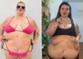 Após eliminar 85 kg, Thais Carla compartilha foto comparativa e celebra transformação corporal