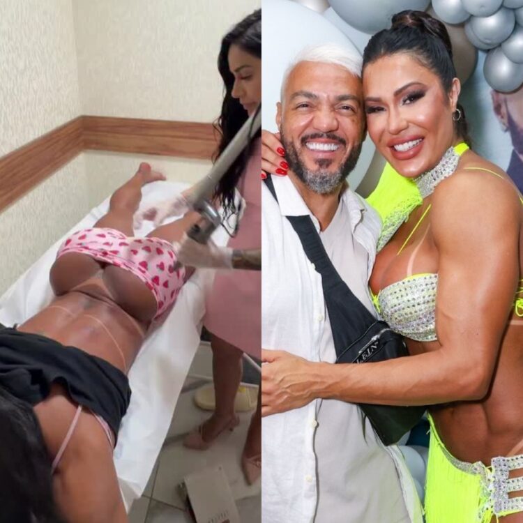 Ao som de Belo, Gracyanne Barbosa inicia remoção de tatuagem íntima com nome do ex e cena viraliza