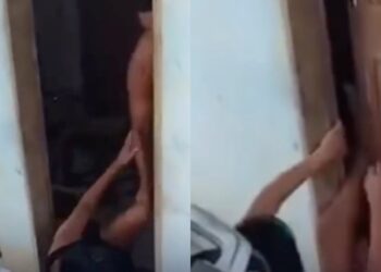 Mulher é agredida e quase tem pernas quebradas ao ser expulsa de casa pelo companheiro