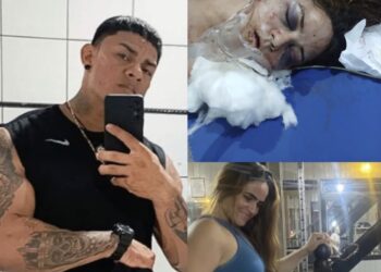 Em Tomé-Açu, mulher fica em estado grave após agressão brutal do companheiro