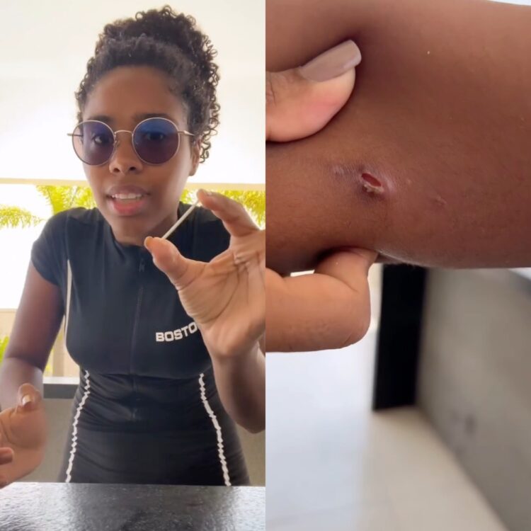 Vídeo mostra momento em que implante anticoncepcional sai do braço de mulher