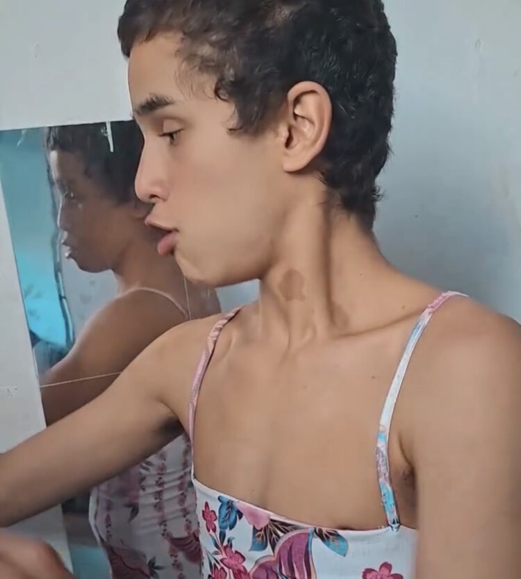 Mãe explica condição do filho e comenta possível hiperfoco em roupas femininas