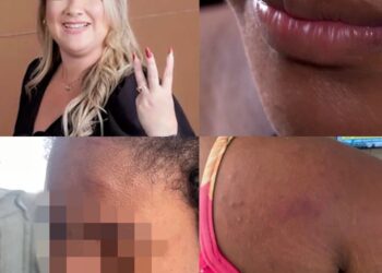 Em áudio, patroa confessa ter agredido empregada doméstica grávida no Maranhão