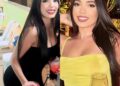 Mulher de 27 anos morre após cirurgia de lipoaspiração com enxerto no glúteo, em Belo Horizonte