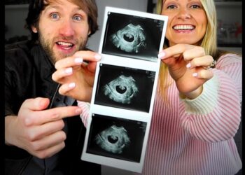 Não é uma bênção’: Youtuber famoso e esposa interrompem gravidez após descobrir que bebê poderia nascer com síndrome de Down