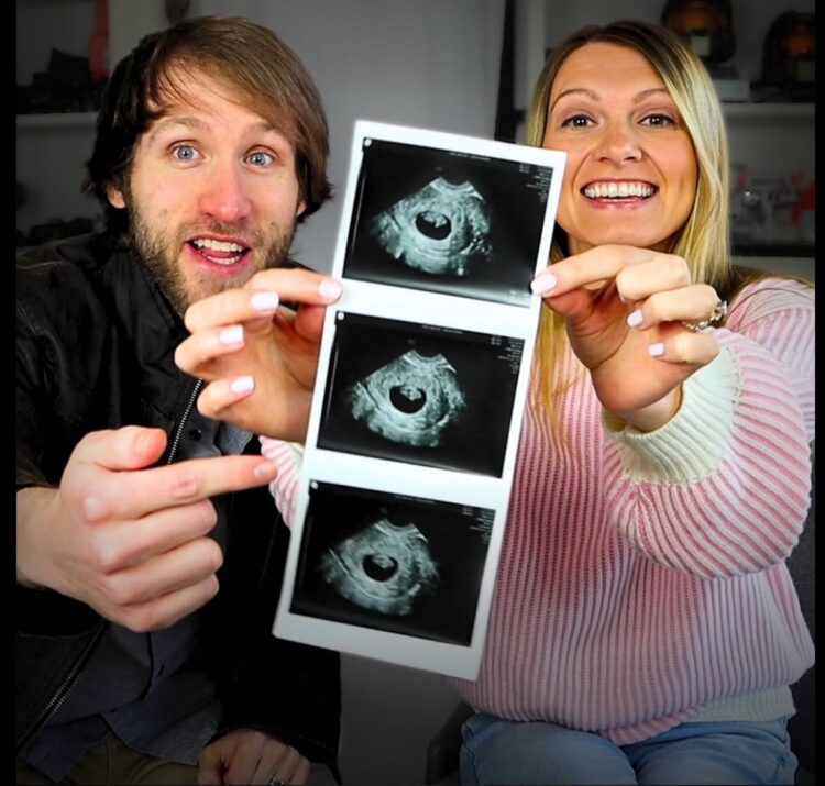 Não é uma bênção’: Youtuber famoso e esposa interrompem gravidez após descobrir que bebê poderia nascer com síndrome de Down